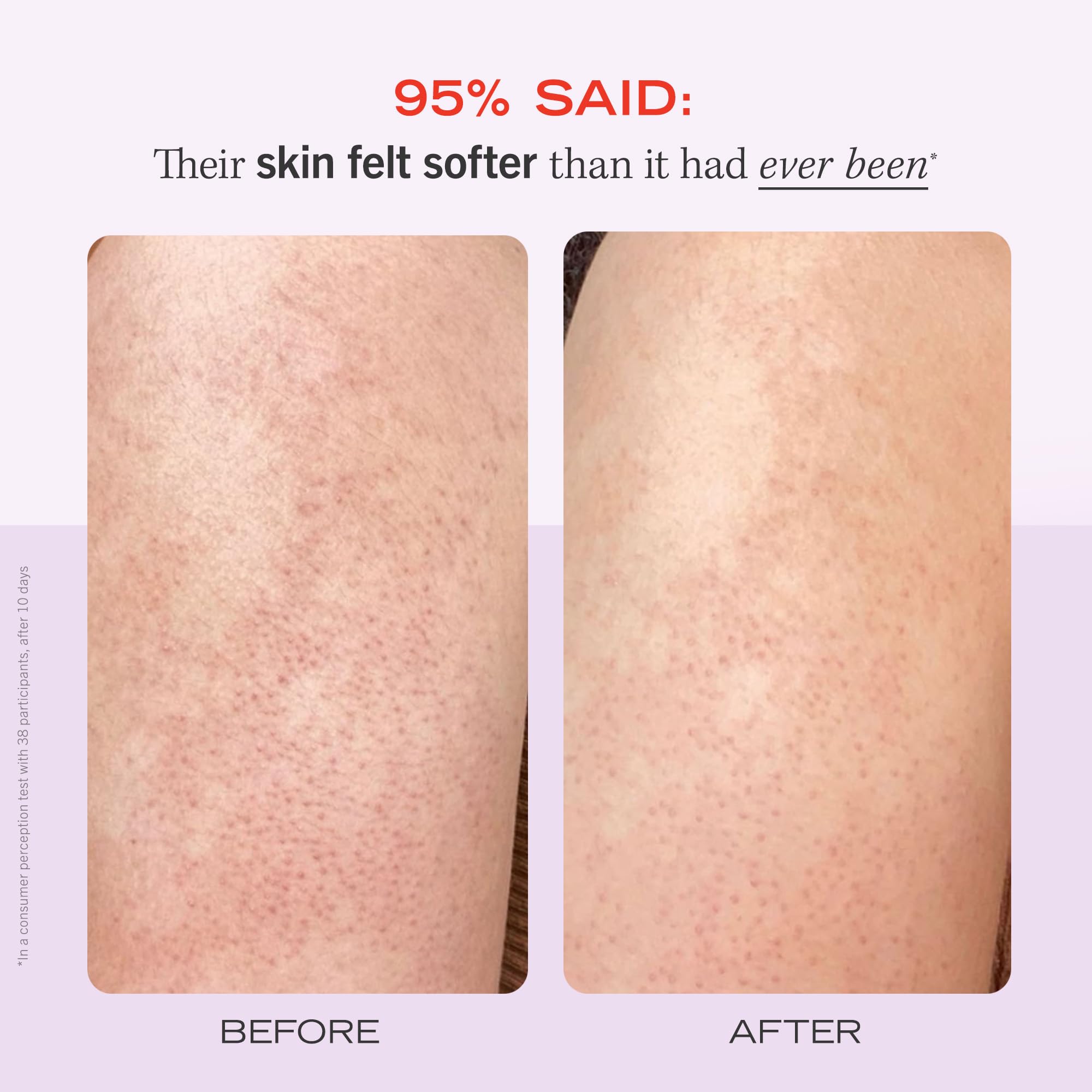 First Aid Beauty - KP Bump Eraser Body Scrub with 10% AHA, Keratosis Pilaris Exfoliater with Glycolic and Lactic acids, Helps Reduce Chicken Skin Bumps, Safe for Sensitive Skin, Strawberry Scent, 226g
