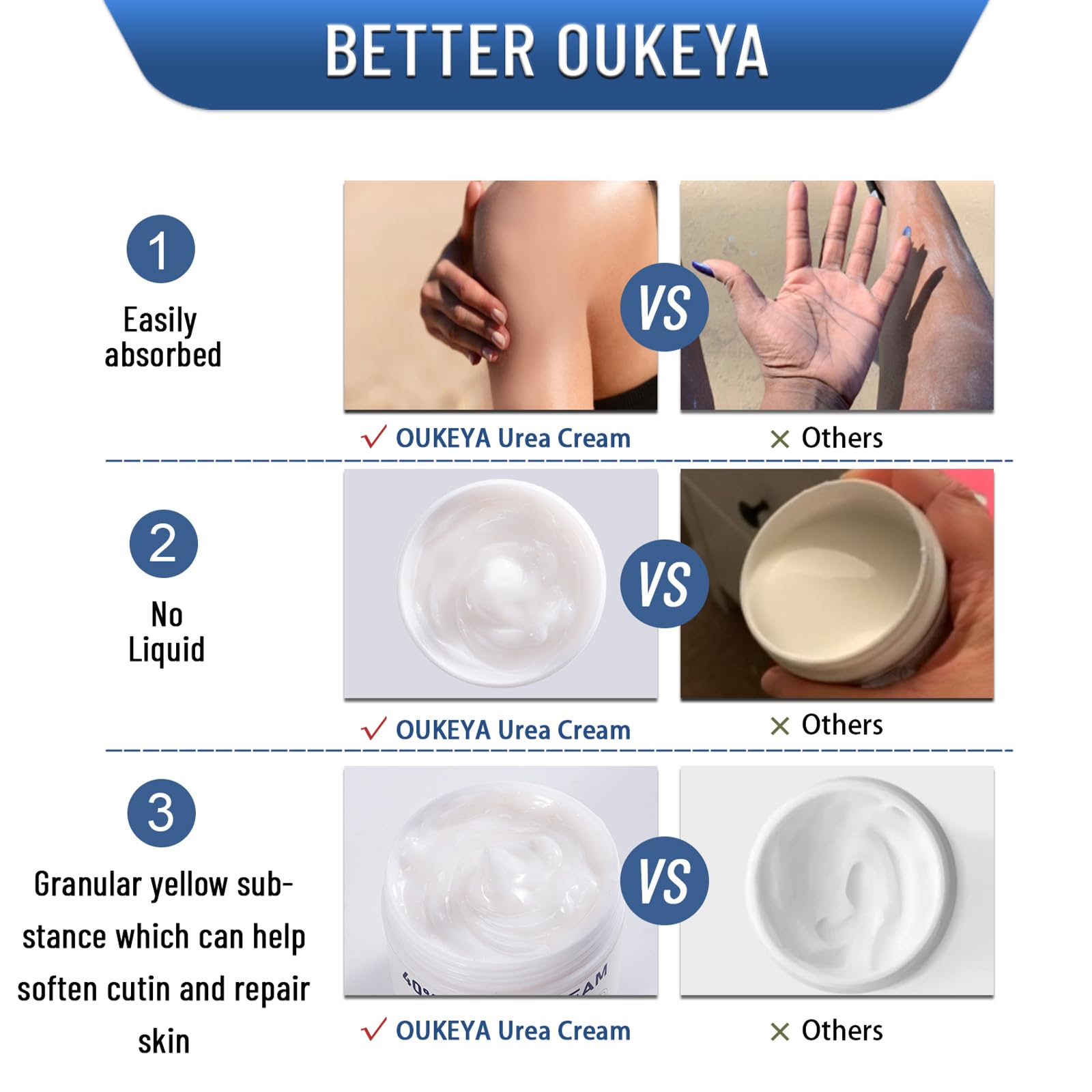 OUKEYA Urea Cream 40 Percent, Urea Foot & Hand Cream for Cracked Heels and Dry Skin, Urea Lotion for Deep Moisturizing, Callus Remover Nourishes Soften, Foot Moisturiser for Women&Men,Maximum Strength