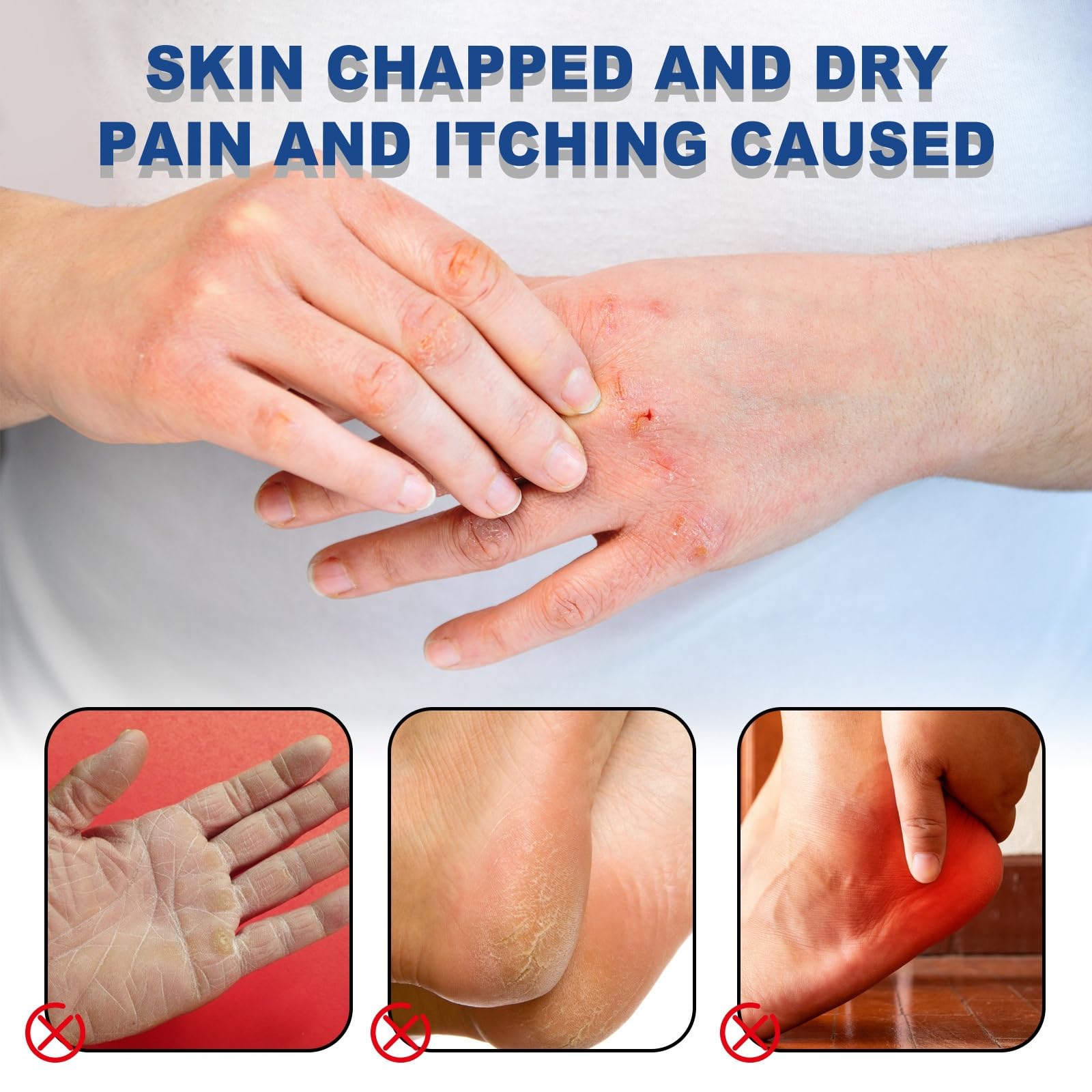 Urea Cream 60 Percent for Feet,4PCS Urea Foot Cream Upgrade Set with 2PCS 60% Urea Foot Cream,1Pairs Moisturizing Socks and 1 Foot File,Cracked Heel Repair Cream,Cracked Heels and Dry Skin