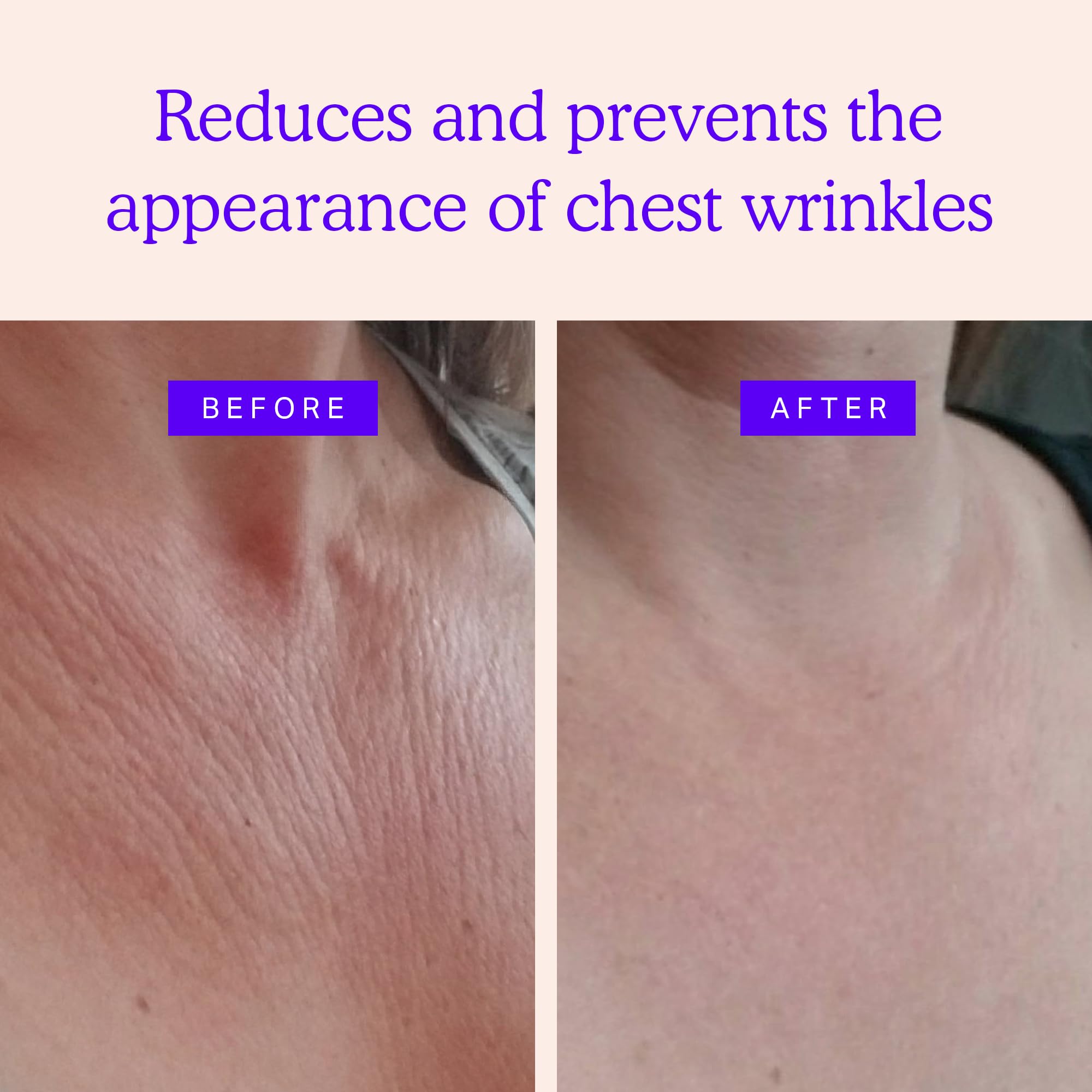 Chest Wrinkle Pads - Silicone Anti Wrinkle Patches for Wrinkles Smoothing - Reusable Overnight Silicone Wrinkle Patches - Anti Aging Silicone Chest Pad & Patch - Neck & Décolleté (1-mo Supply)