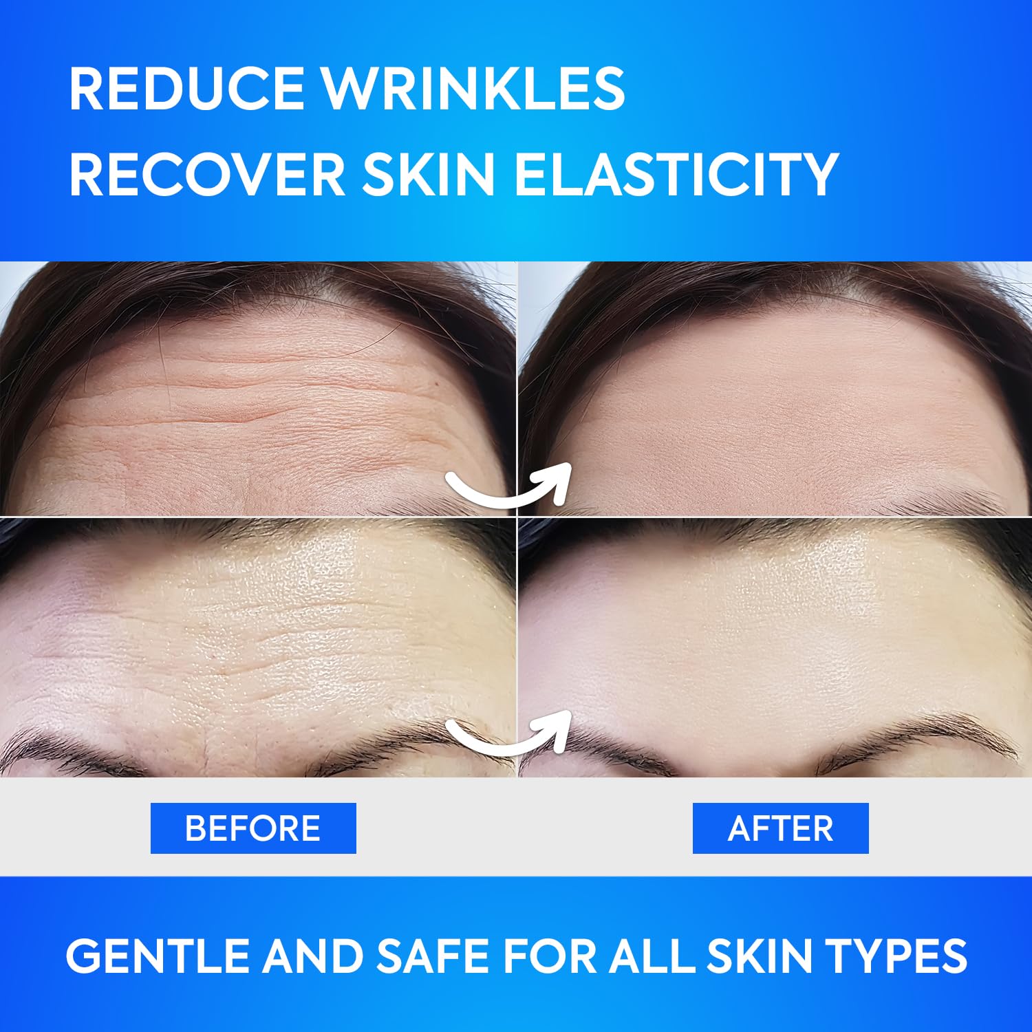 SILKDERMIS Forehead Wrinkle Patches, Moisturising Anti-Ageing Treatment, 12 Pcs