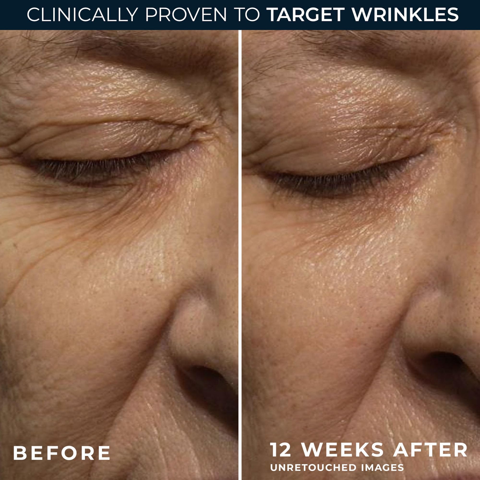 RoC Retinol Correxion Wrinkle Correct Night Cream | Wrinkle Reducing Moisturiser for Face | 30 ml