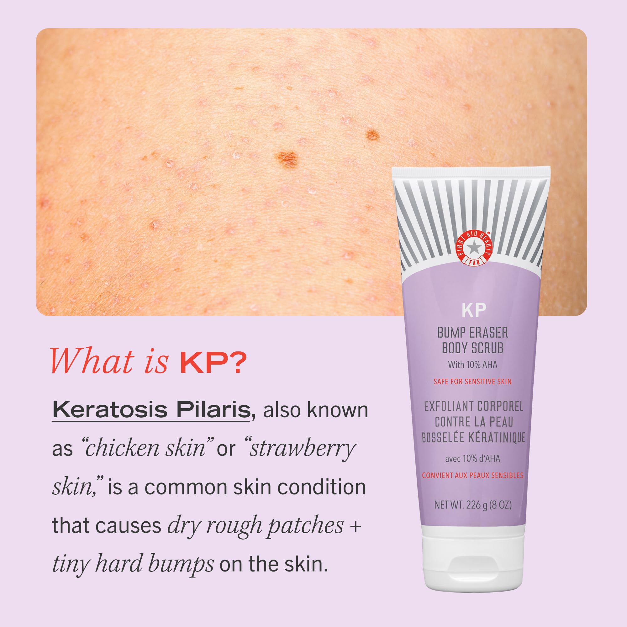 First Aid Beauty KP Bump Eraser Exfoliating Body Scrub Exfoliator for Bumps + Chicken Skin from Keratosis Pilaris with 10% AHA (Glycolic + Lactic Acids) 226 g