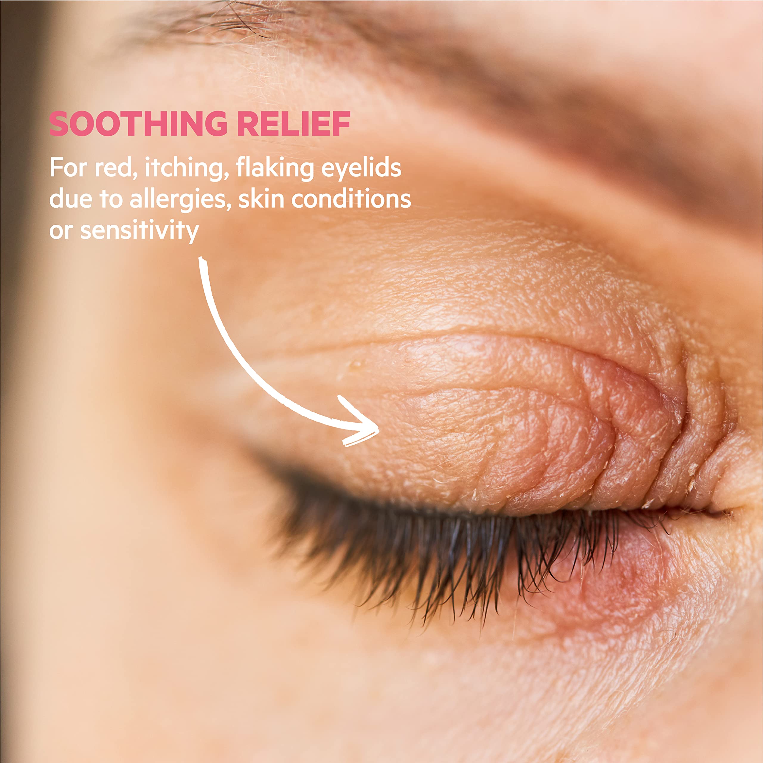 SVR PALPEBRAL Soothing Eczema Eye Cream for Dry, Sensitive, Itchy, Flaky Eyelids Prone to Irritation and Blepharitis, Steroid-free Formula, 15ml
