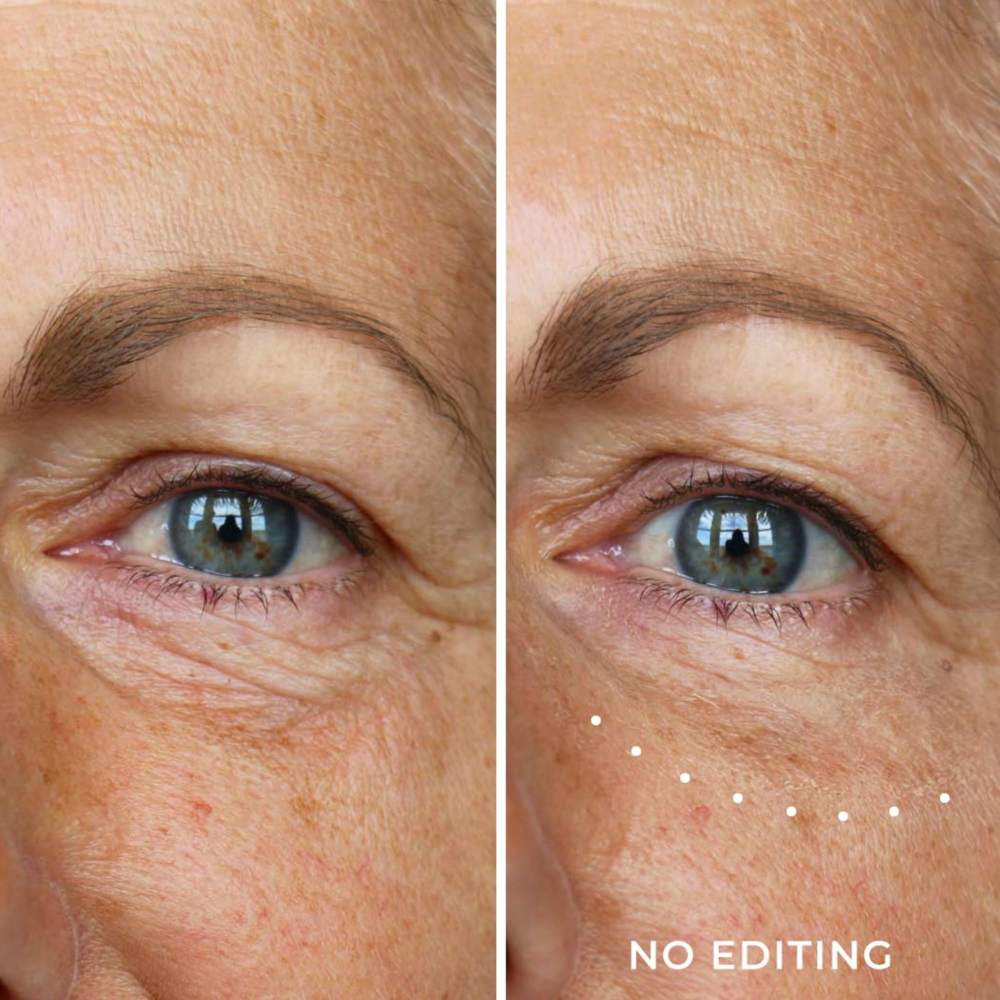 WUNDERBROW Wunderlift Instant Eye Tightening Serum, Temporary Firming & Lifting Treatment in 60 Seconds, Reduces Under-Eye Bags, Dark Circles, Puffiness, Anti-aging Fine Lines