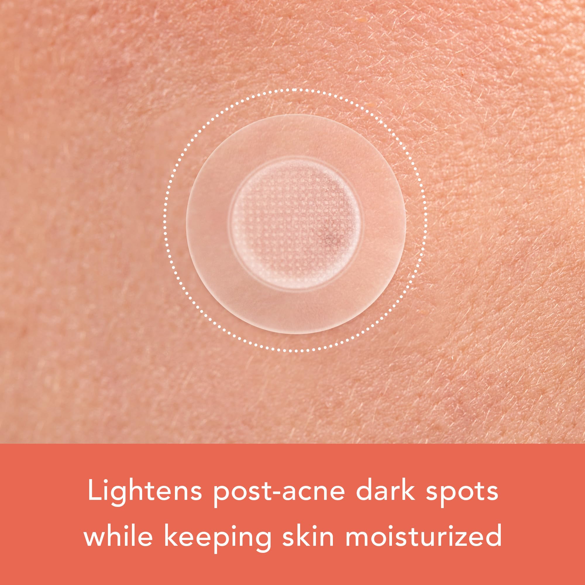Rael Pimple Patches, Miracle Microcrystal Vitamin C Dark Spot Cover - Korean Skincare, Post Acne Mark Remover Correcting Treatment, w/ Glutathione, Niacinamide, Hydrocolloid, Vegan (9 Count)