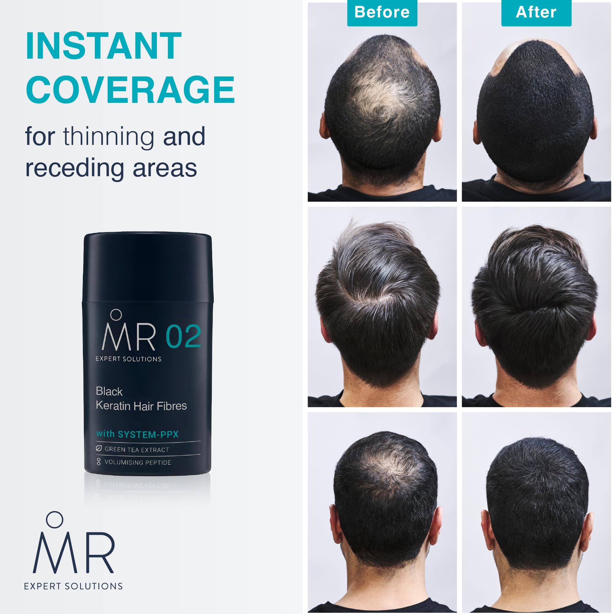 MR Dark Brown Hair Fibres (15g). Paraben Free Hair Loss Concealer with System-PPX, Thinning Hair Concealer for Bald Patch Cover Up, Hair Fibres Dark Brown, Hair Thickener for Men, Hair Texture Powder