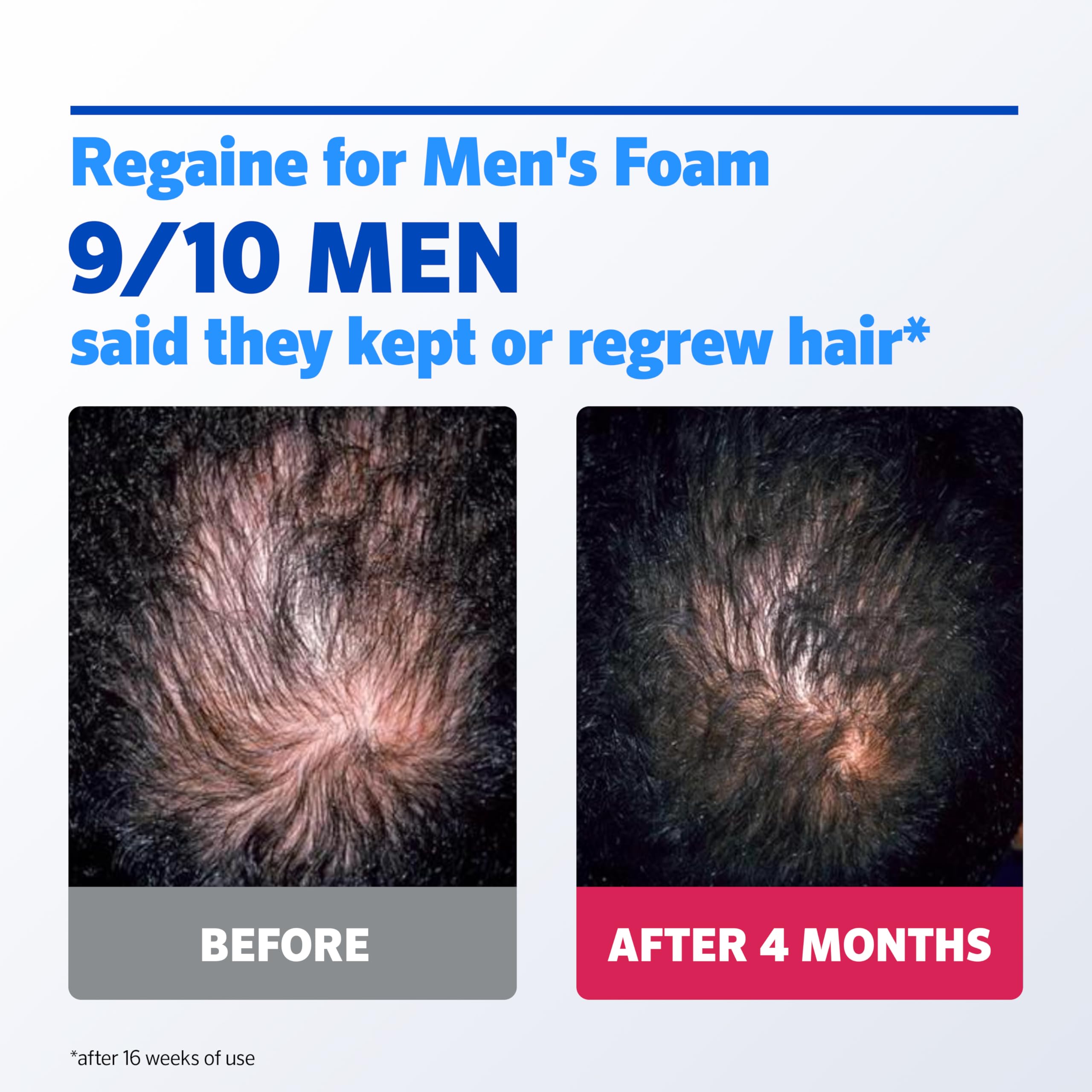 Regaine For Men Extra Strength Foam - Scientifically Proven To Help Stop Hereditary Hair Loss - Minoxidil Foam for Hair Regrowth - 73ml, Packaging may vary