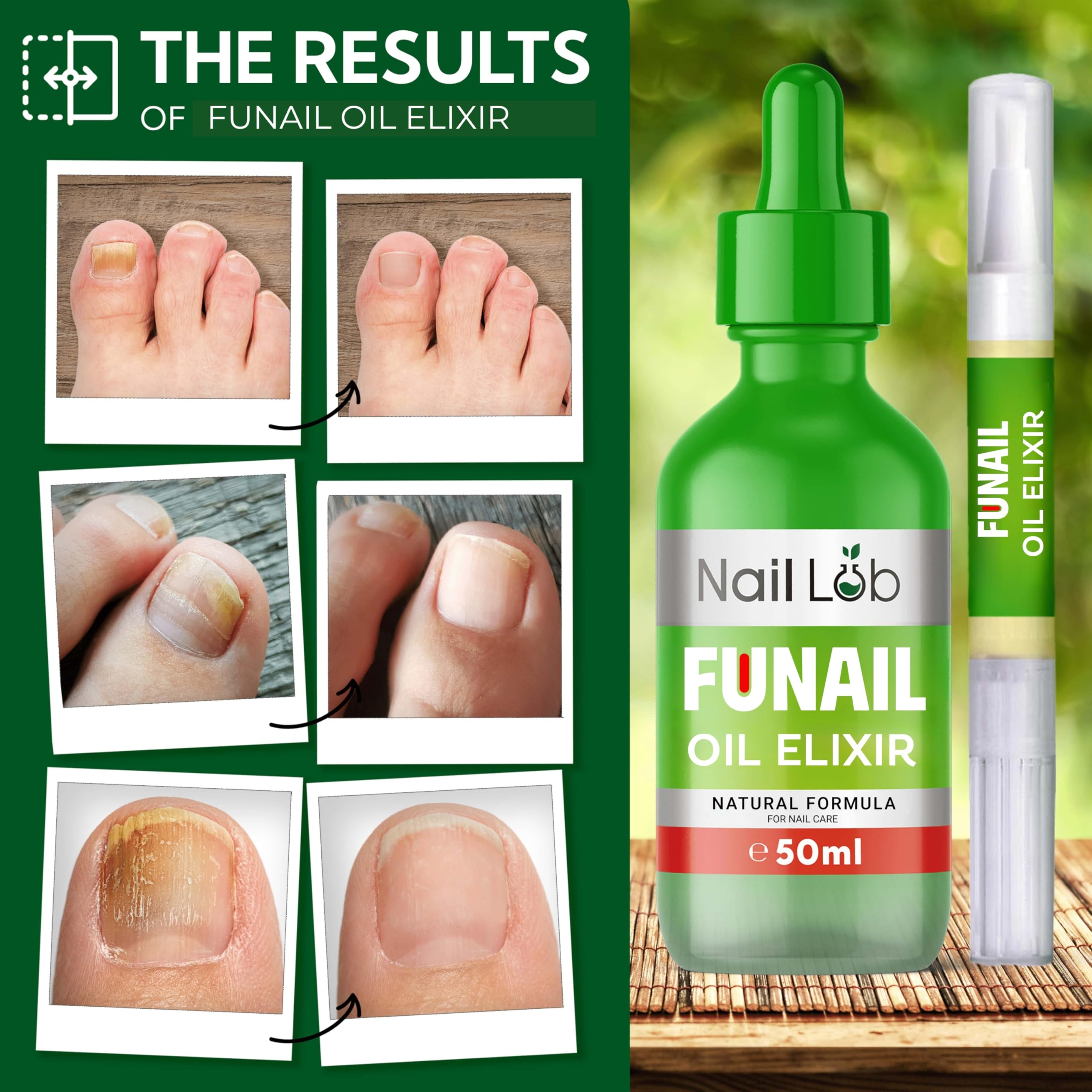 NAIL LAB Premium Fu Nail Elixir for Toenails Extra Strong - 50ml - Contains Tea Tree Oil, Nail Repair for Fingernails - Free 3ml Fu Nail Pen + Nail File
