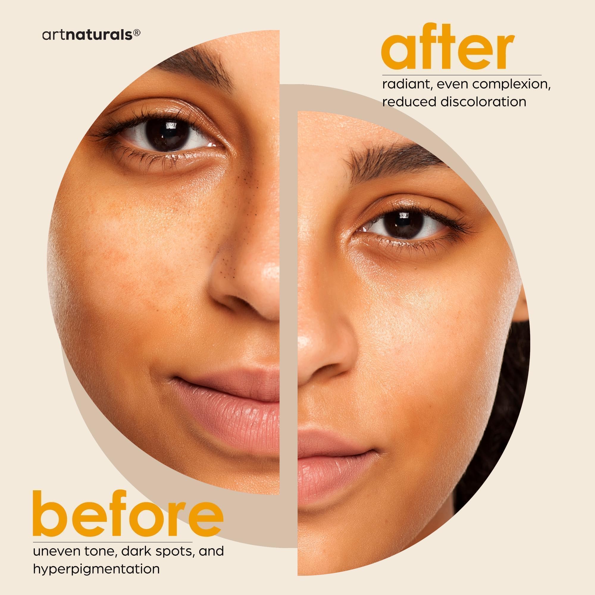 Kojic Acid Soap + African Net Sponge (2 pack X 142g Turmeric bars) Dark spot remover, Hyperpigmentation & Scars - Original Japanese Complex Vitamin C, Hyaluronic Acid, retinol, shea butter (Citrus)