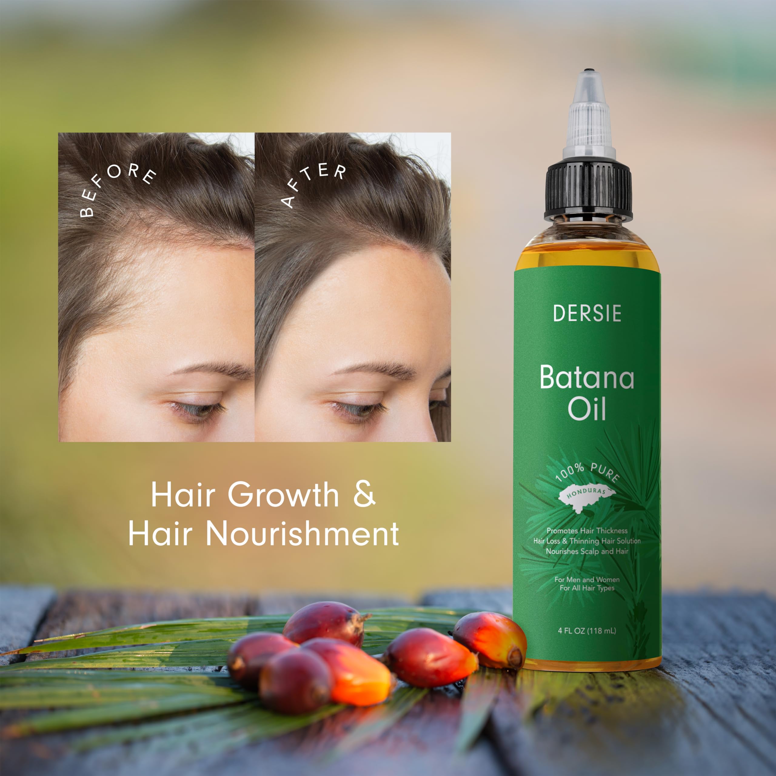 Dersie Batana Oil for Hair Growth Dr Sebi - 100% Pure & Natural Raw Oil From Honduras - For Thicker & Stronger Hair - 4 FL OZ