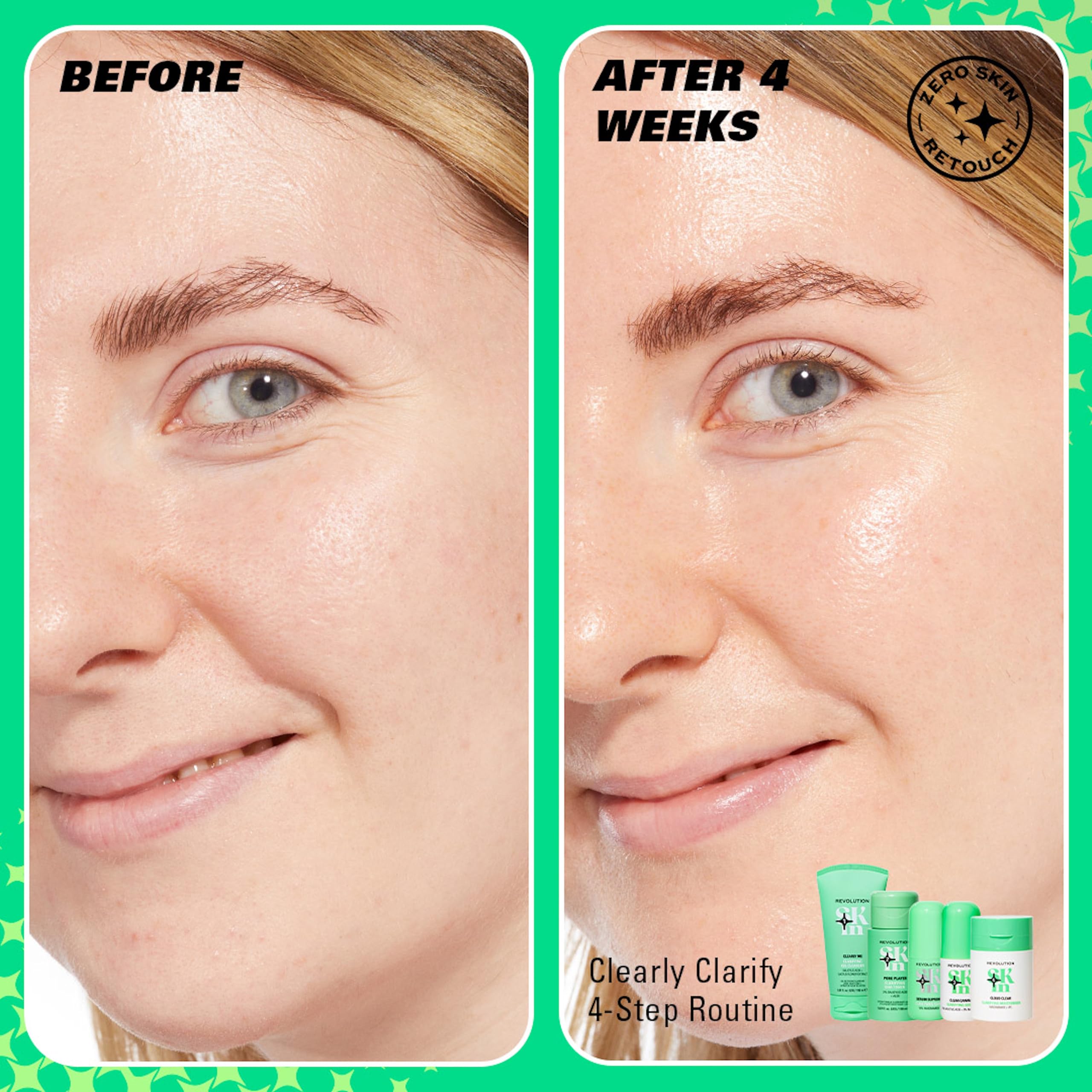 Revolution Skin, Clearly Clarify 4 Step Starter Kit, Skincare Set for Blemish-Prone Skin, Includes Cleanser, Toner, Serum & Moisturiser, Vegan & Cruelty-Free, 4 Products Included