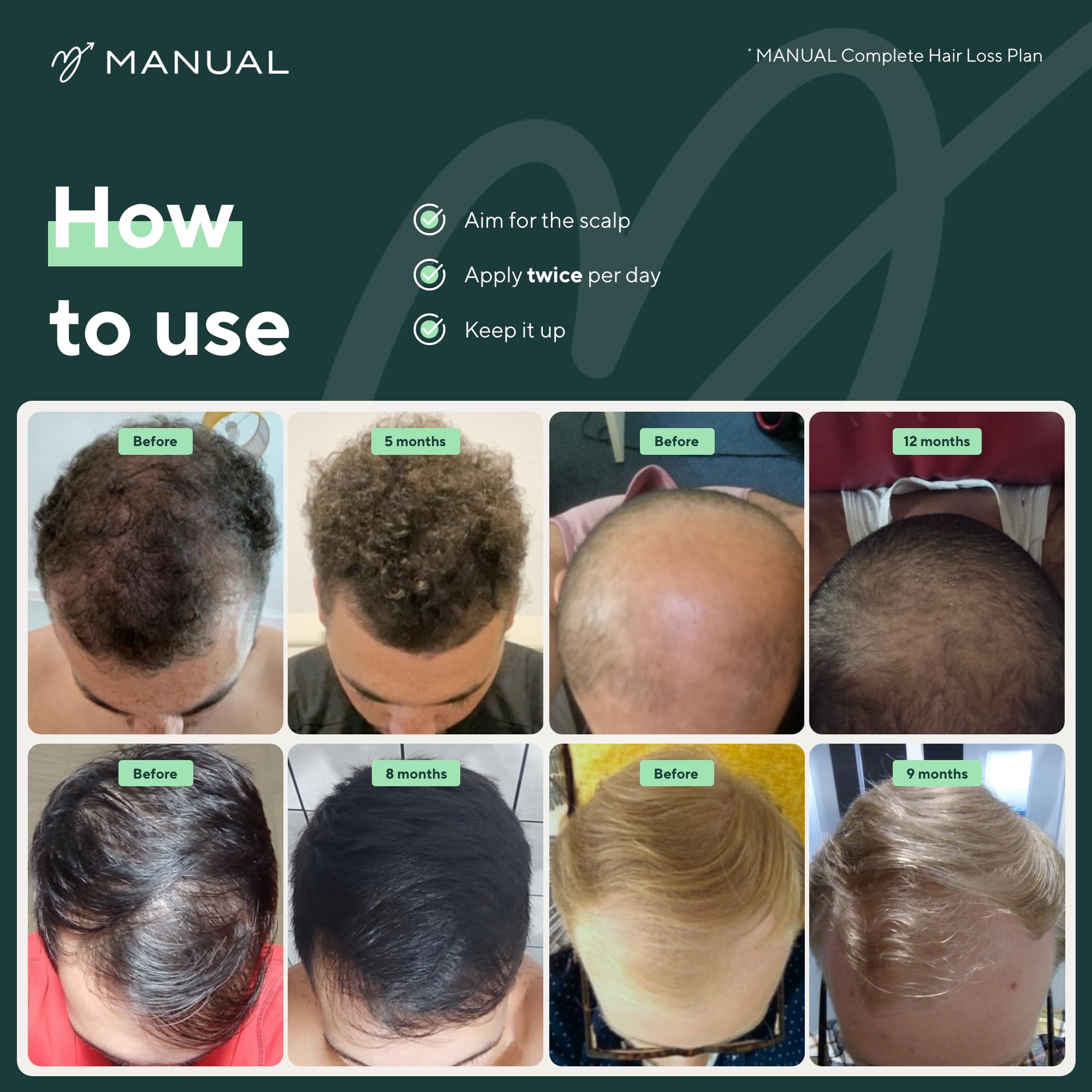Manual 5% Minoxidil (1 x 60ml) Formula For Men - Increases Blood Flow To Follicles - Promotes Growth for Longer, Thicker Hair - Stimulates Hair Regrowth - Easy To Apply Spray - 1 Month Supply