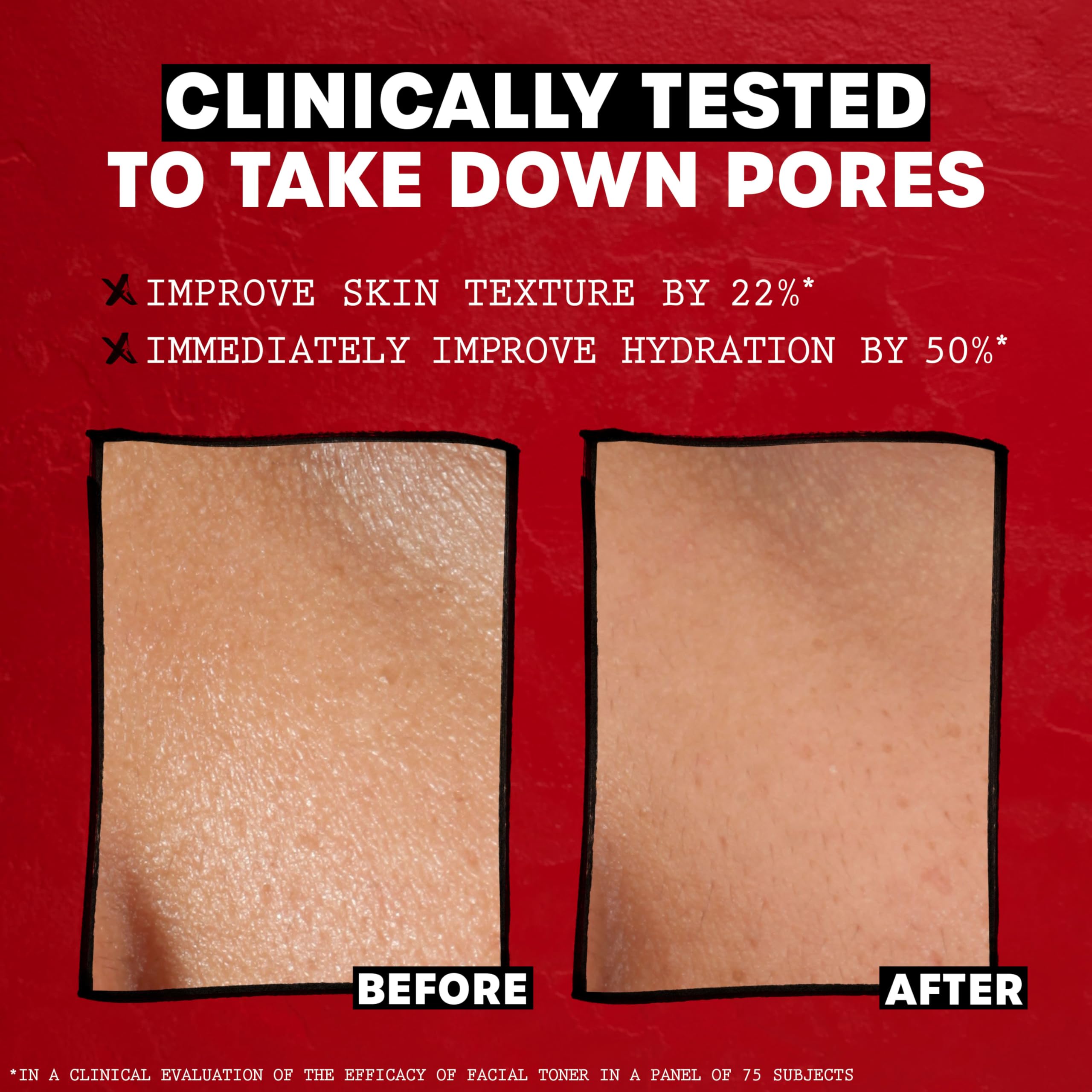 THAYERS Alcohol-Free, Hydrating, Unscented Witch Hazel Facial Toner with Aloe Vera Formula, Vegan, Dermatologist Tested and Recommended, 12 Oz (Packaging May Vary)