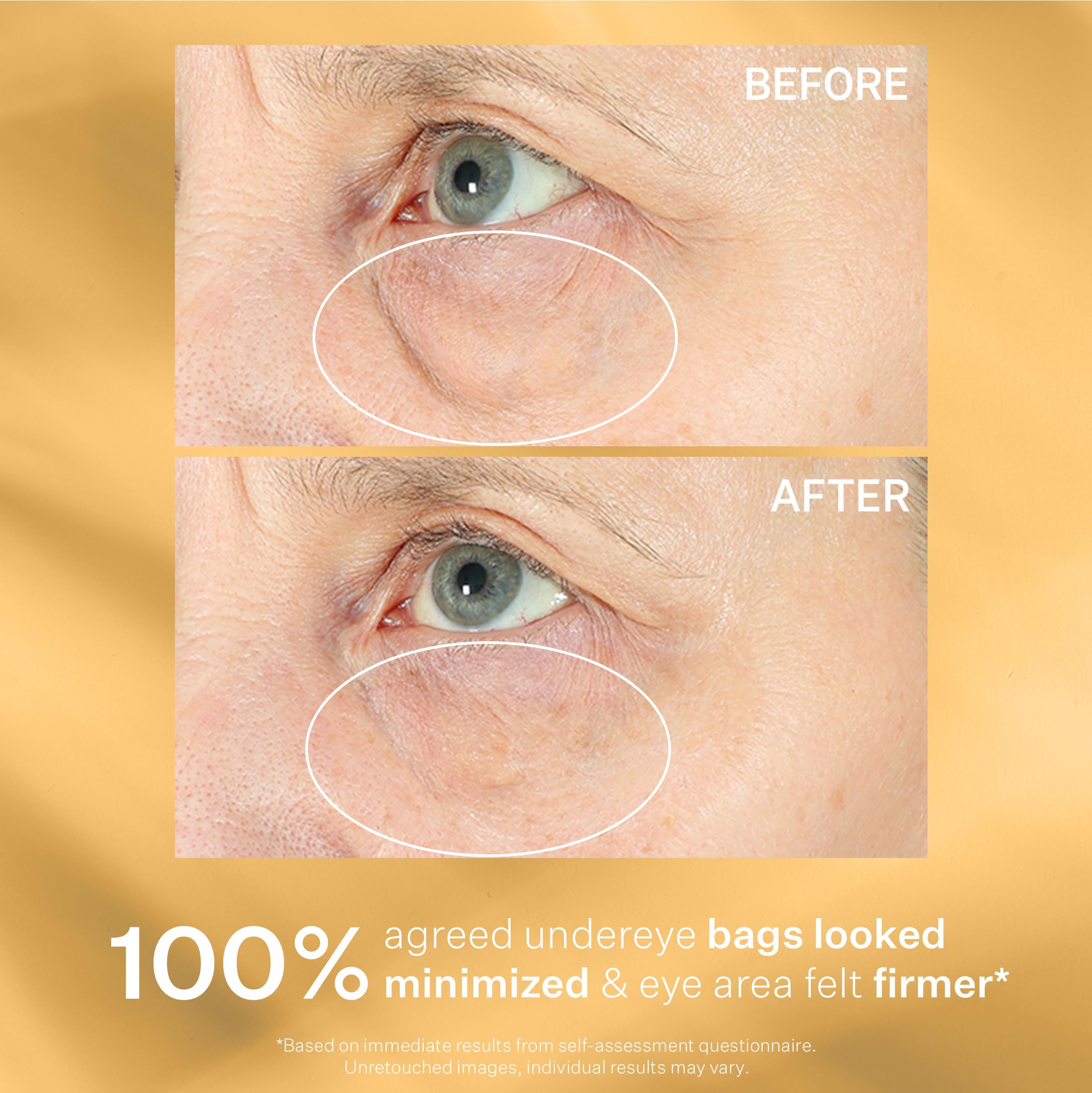 StriVectin Tighten & Lift Hyperlift Eye Cream (0.34 Oz, 10ml)| Instant Eye Fix, Tightening Treatment for Bags, Lines and Crepiness