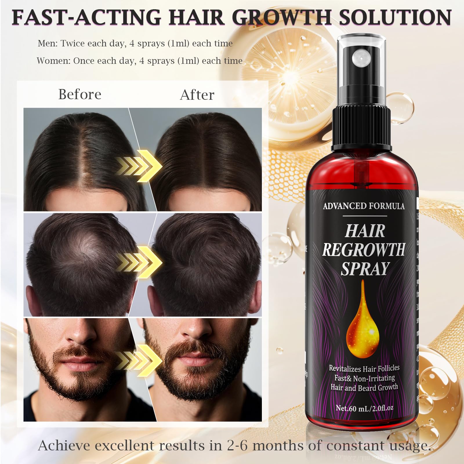 AMAINKI 5% Active Ingredient m-i-x-i-d Hair Growth Serum,Hair Regrowth,Hair Loss Treatment,Beard Growth, Contain Rosemary Oil for Hair Growth Oil,Upgraded Formula (Refreshing) 60ml