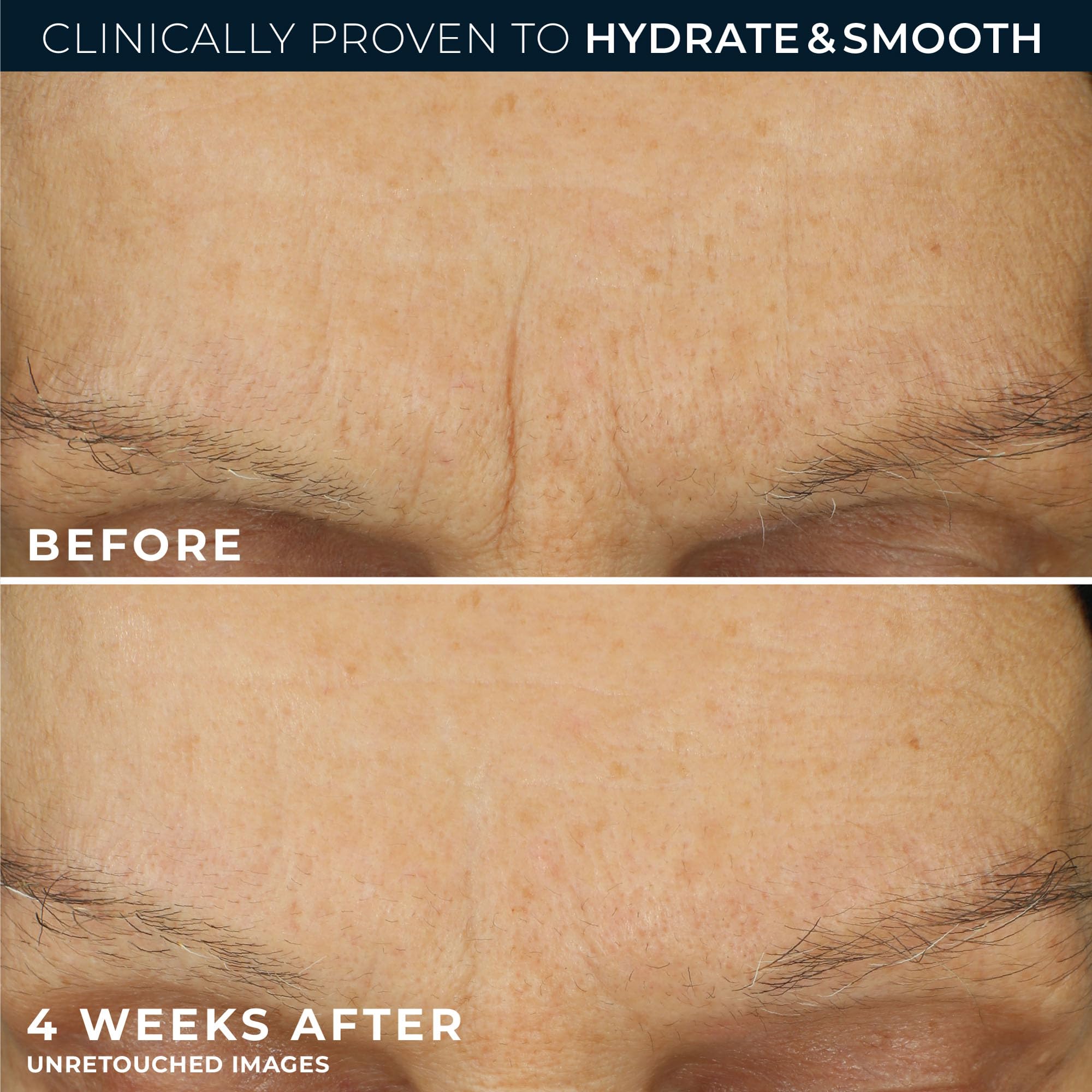 RoC Retinol Correxion Line Smoothing Max Hydration | Face Cream with Hyaluronic Acid, Anti-Wrinkle Moisturiser | 50 ml