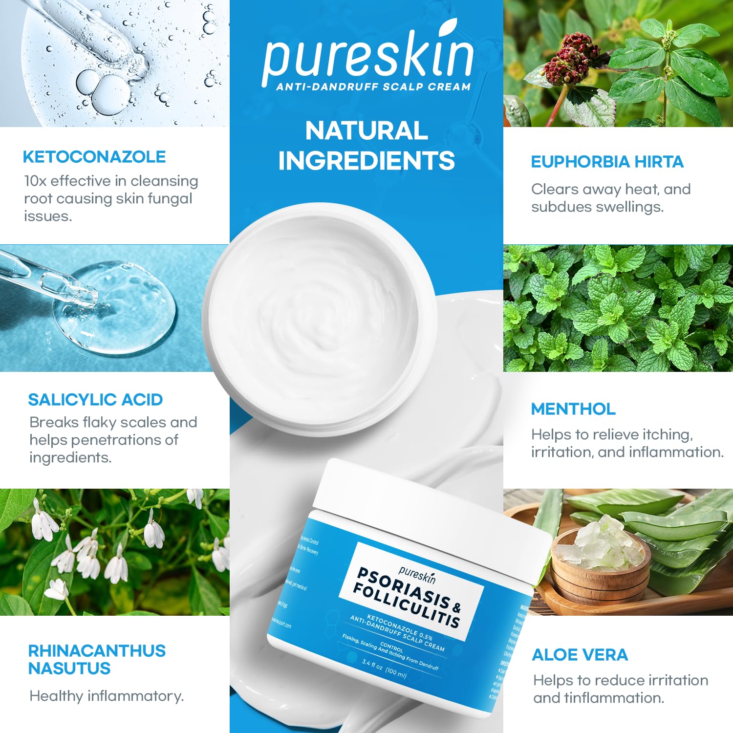PURESKIN Psoriasis Scalp Treatment Cream - Extra Strength for Scalp Psoriasis Folliculitis - Controls Itching Flaking Stubborn Dandruff 3.4 Oz