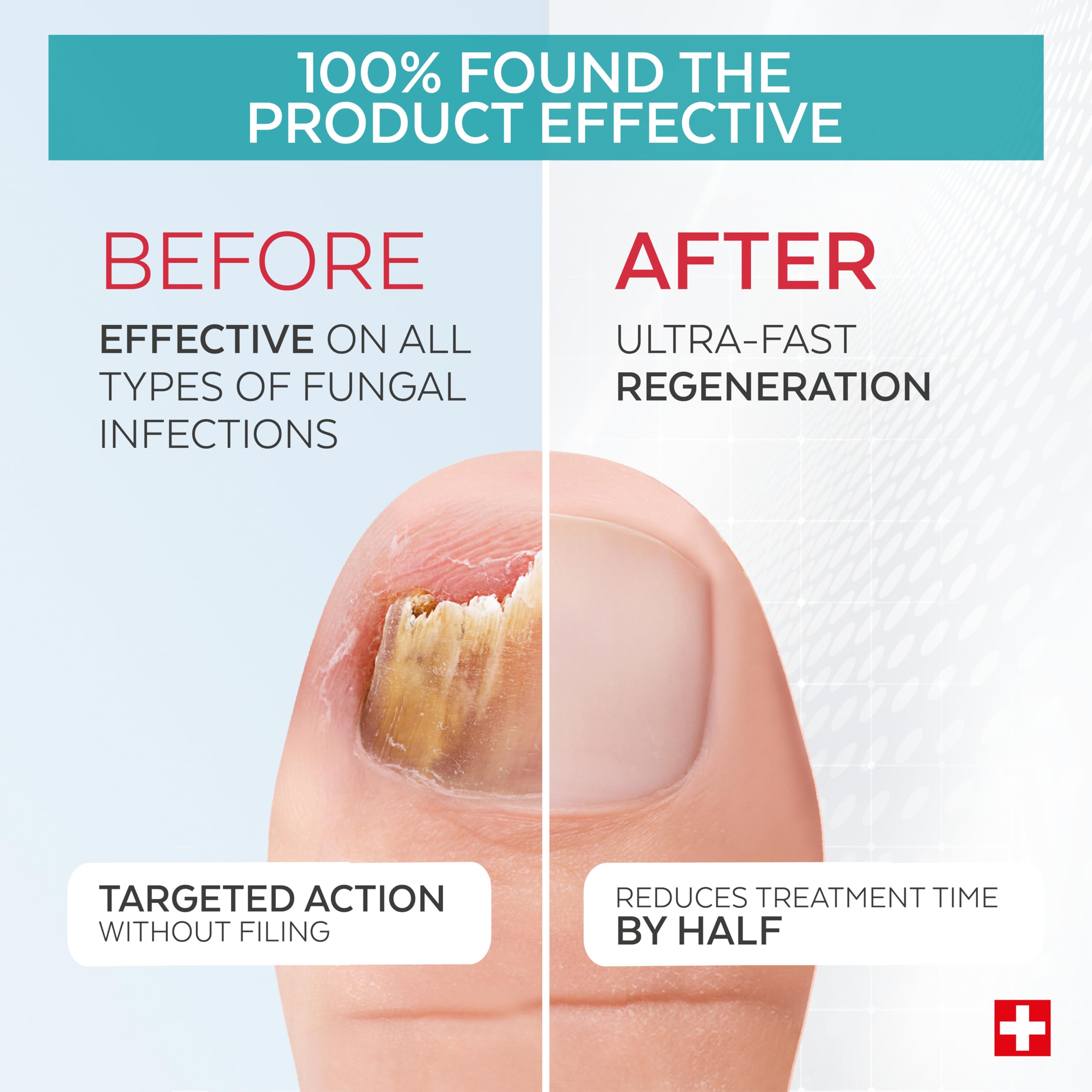 Poderm Pack Duo 2-in-1 Fungal Nail Treatment for Severe Nail Infections | Swiss-Made Serum & Booster | No Filling Needed | FungiGone Nail Fungus Treatment for Damaged Toenails | Podiatrist Developed