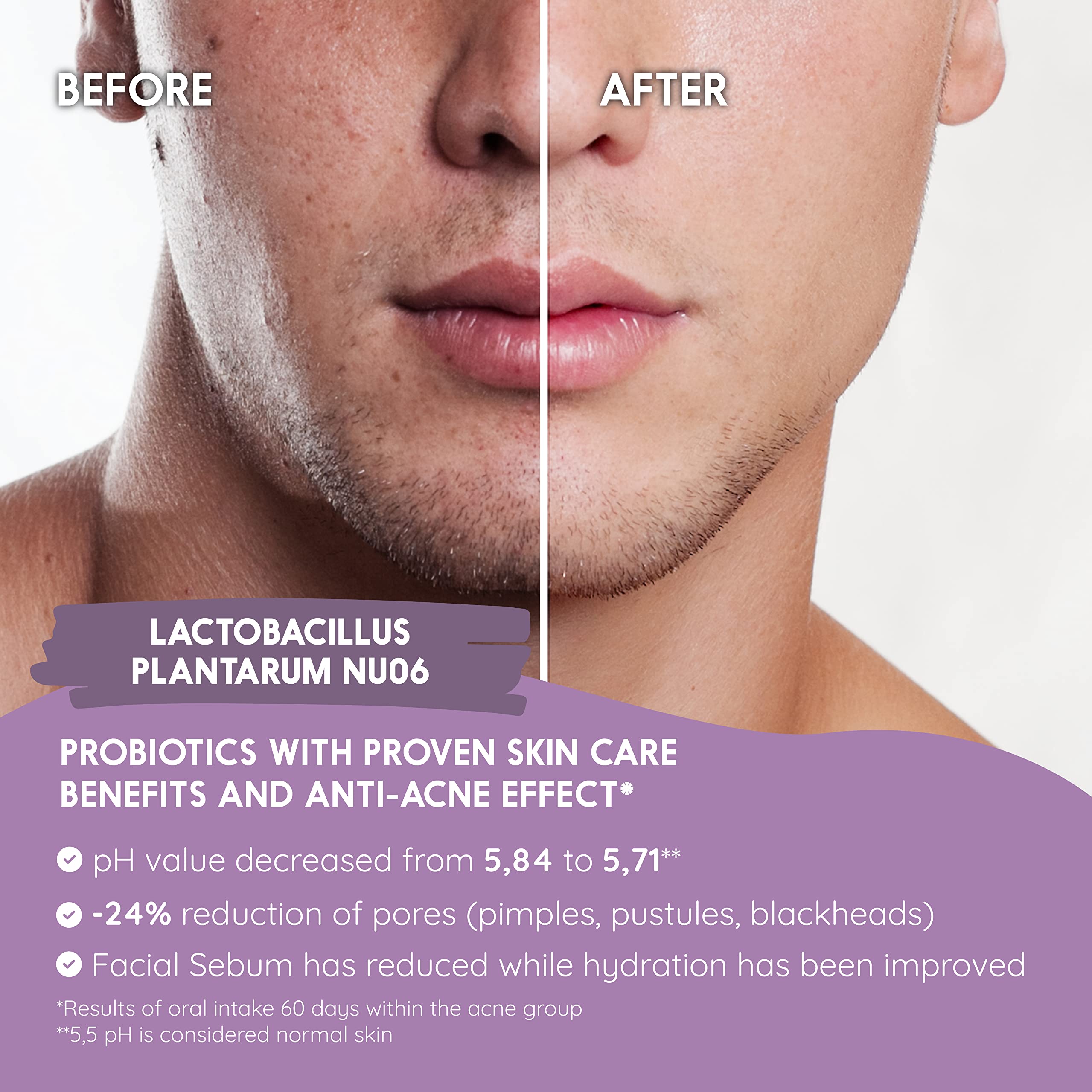 Probiotics for a Healthy Skin. Reduces Spots & Imperfections. Anti Acne effect. Improves Elasticity, Firmness & Luminosity. With SKINAX²™, Zinc & Vitamins. 45 capsules. CE. Vegan. N2 Natural Nutrition