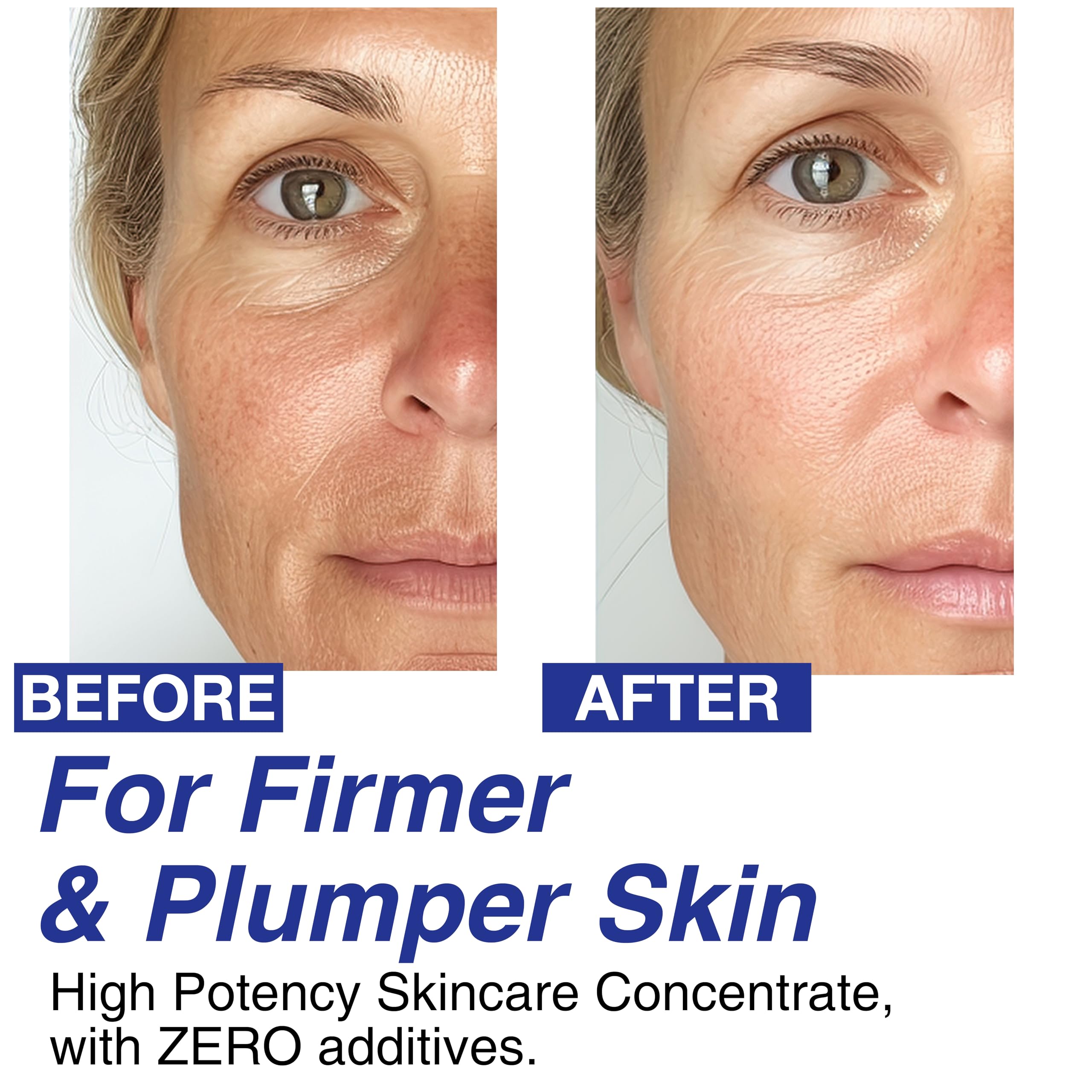 CELDYQUE - 100% Pure Volufiline Serum: Experience the full performance of the 100% Pure Volufiline CELDYQUE Serum, which is responsible for its exceptional firming and volumising effects of the skin