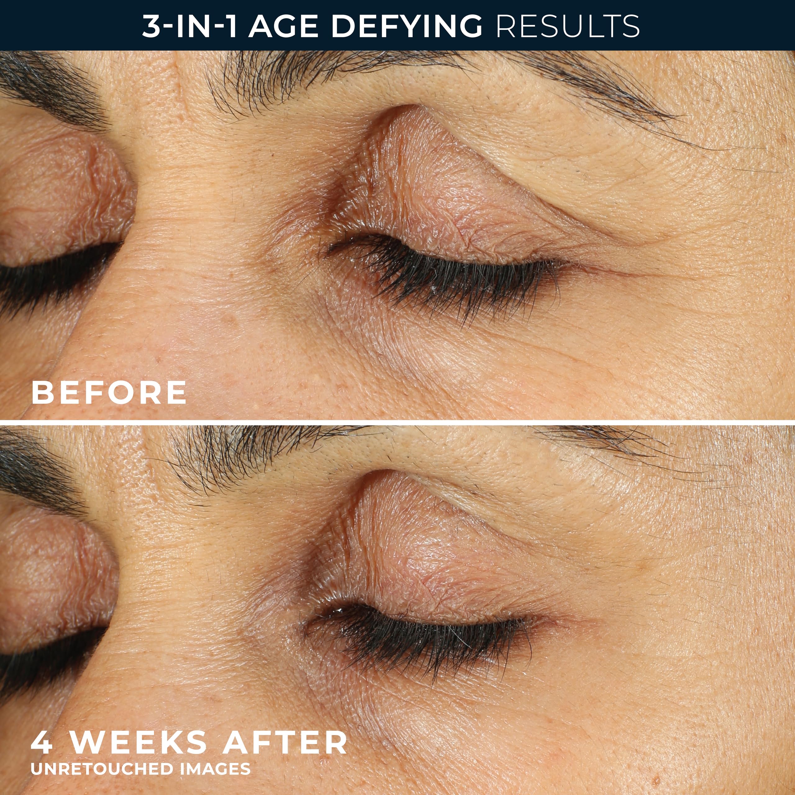 RoC Retinol Correxion Line Smoothing Eye Cream | For Wrinkles, Dark Circles & Puffy Eyes | 15 ml