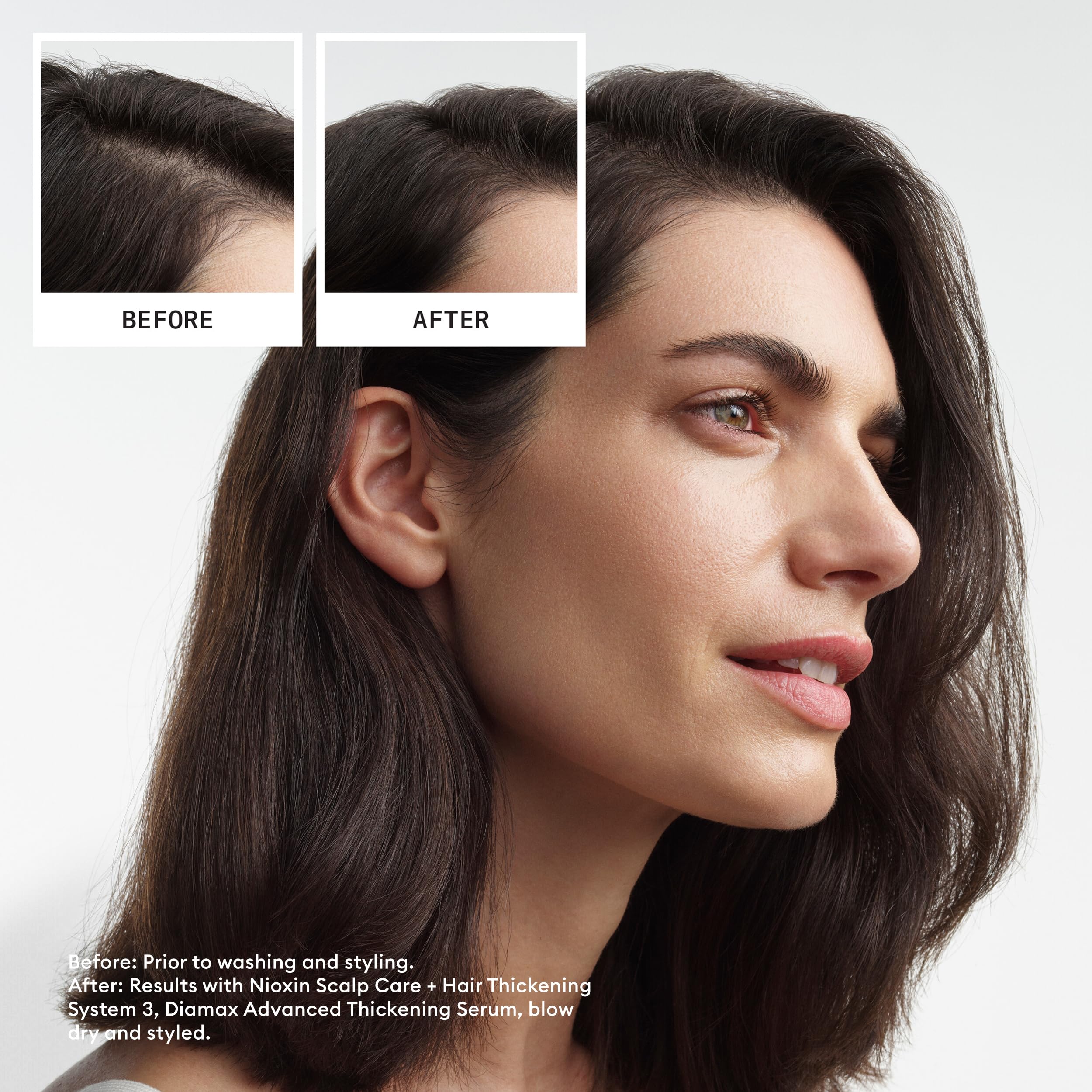 Nioxin Scalp + Hair Thickening System 3 Loyalty Kit - Hair Thickening System for Coloured, Dry and Damaged Hair with Light Thinning - Shampoo, Conditioner and Scalp Treatment, 300+300+100ml