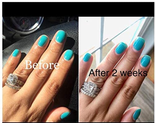 Kanorine® non-acid Gel Power Bond Natural Nail Primer/Acrylic Nails Primer, for all uv/led gel nail polish Bonder Nail Tech Essential Primer no-need-cure0.33oz/ 10mlx1
