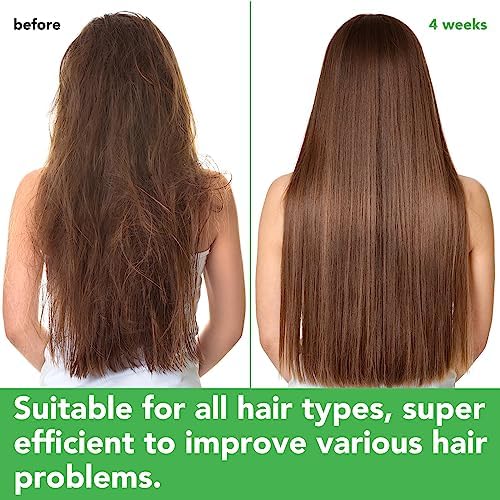Rosemary Shampoo and Conditioner Set, Hair Growth Rosemary Shampoo and Conditioner Against Hair Loss, Nourishes Scalp, Biotin rosemary oil Hair Thickening Products for Women and Men, Sulfate Free