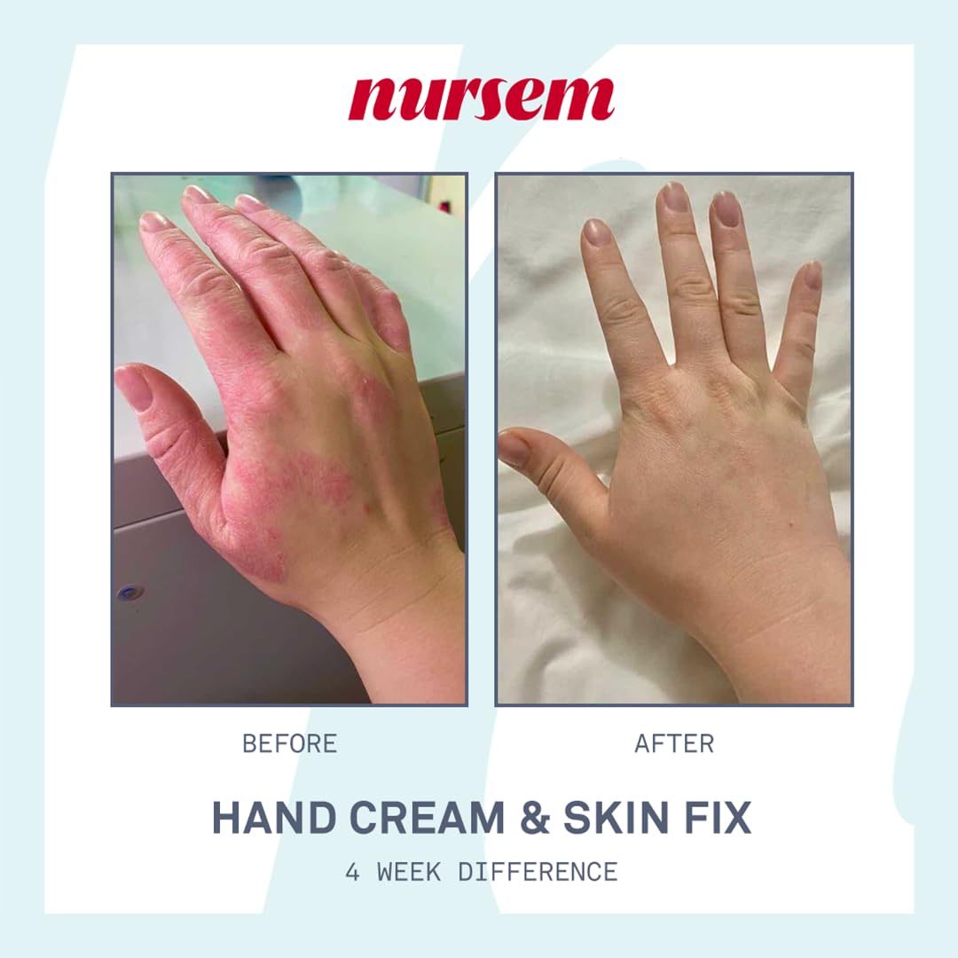 Nursem Caring Hand Cream – 300ml | Fast-Absorbing Natural Hand Cream for Very Dry Skin | Fragranced Moisturizer for Deep Hydration, Skin Repair & Protection for Dry, Cracked Hands