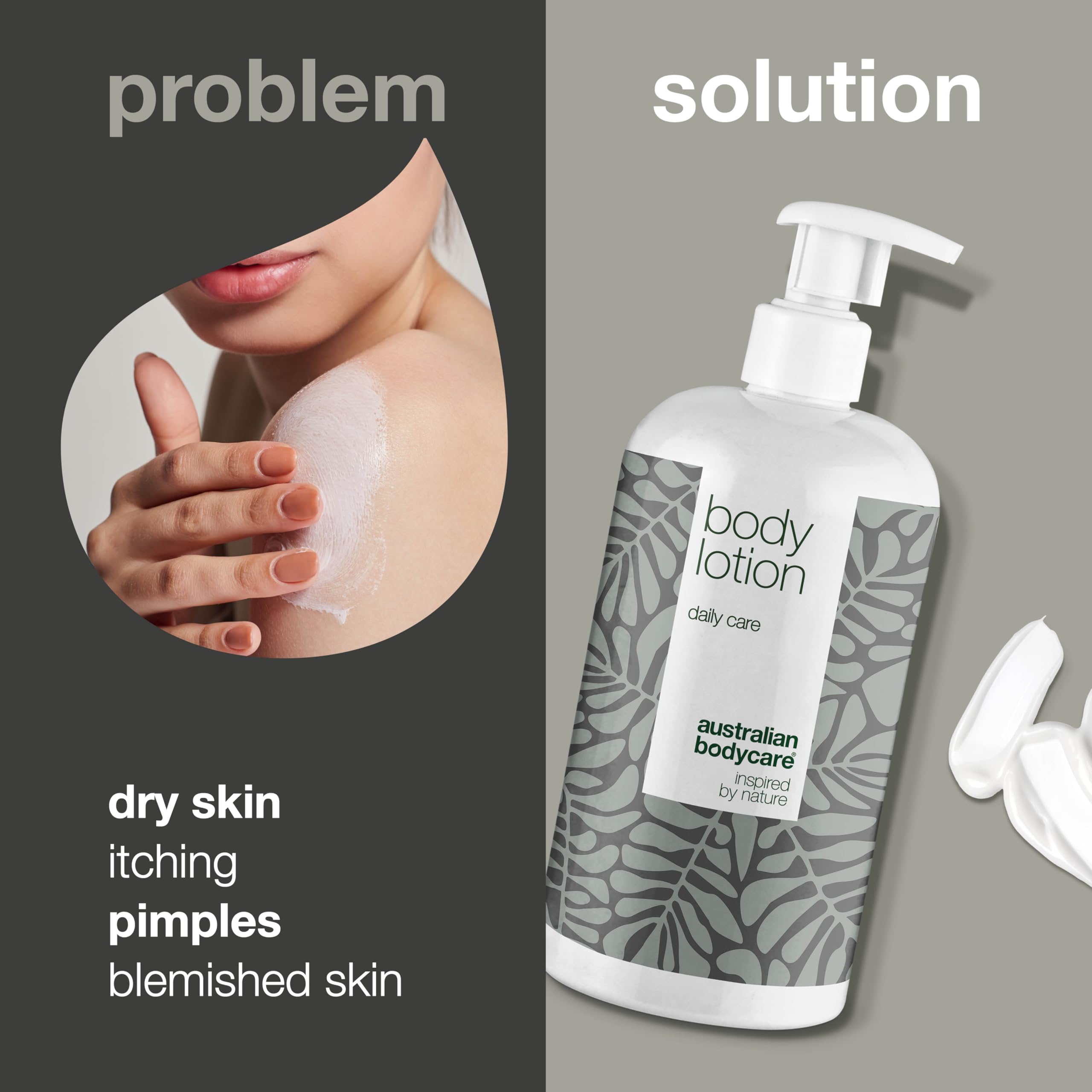 Moisturizing Body Lotion with 4-Terpineol, Known from Tea Tree Oil – Relieves Dryness, Itching, and Irritation | Perfect for Acne-Prone Skin