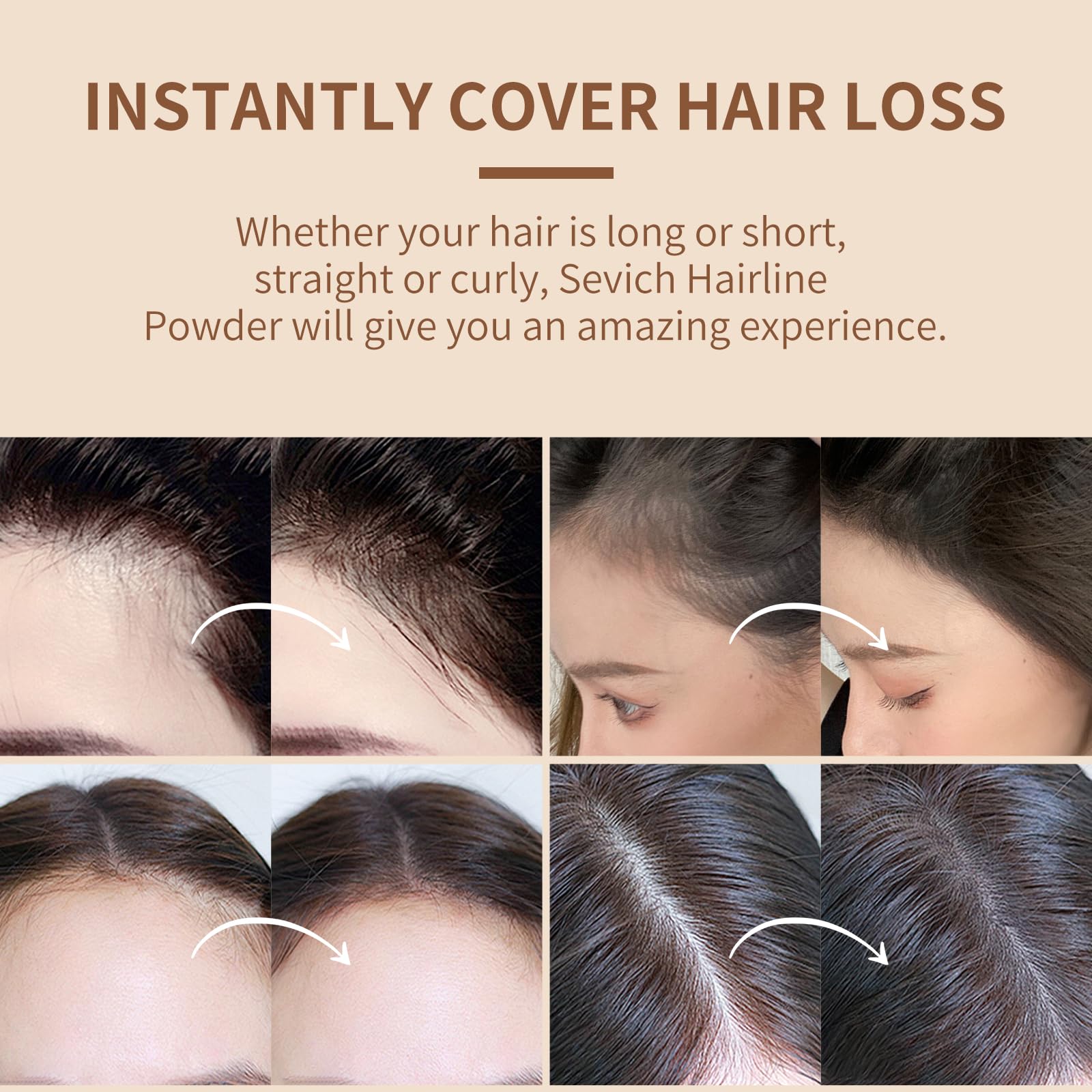 Sevich Hairline Powder，Instantly Conceals Hair Loss, Root Touch up Powder, Hair Shadow Toppers for Women & Men, Touch Up for Thinning Gray Hair, Windproof & Sweatproof, Medium Brown