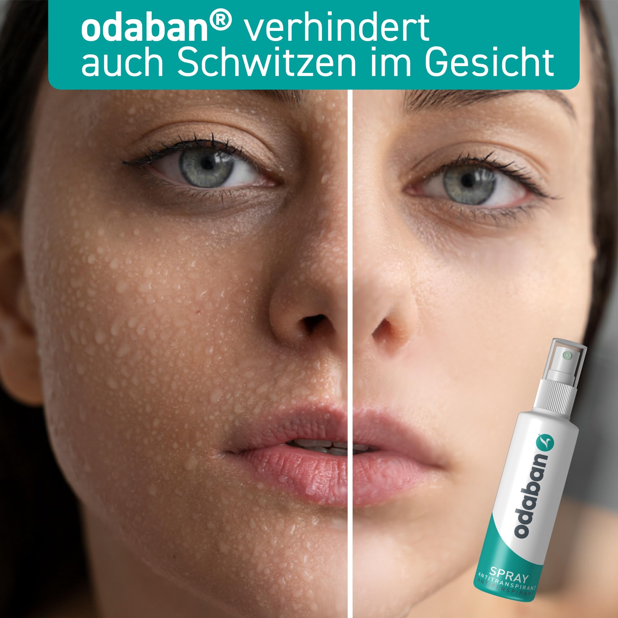 Odaban Antiperspirant Spray, Clinical Strength Aluminium Chloride Strong Antiperspirant Hyperhidrosis Treatment for Excessive Sweating, Fragrance-free