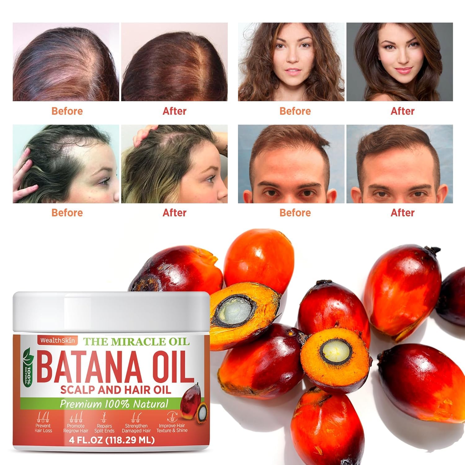 Wealthskin 100% Pure Batana Oil – Cold Pressed in Honduras | Natural Scalp & Hair Oil for Shine, Softness & Thicker-Looking Hair | Raw & Unrefined – 4 fl oz (118 ml)