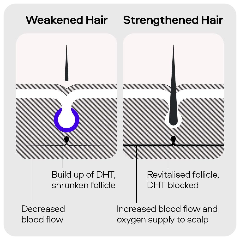 Sons Minoxidil 5% Solution & Hair Growth Shampoo for Men. Hair Regrowth Treatment. DHT Blocker Head Wash with Caffeine. Hair Thickening & Anti-Dandruff Formula. 3 Month Supply. Made in Europe.