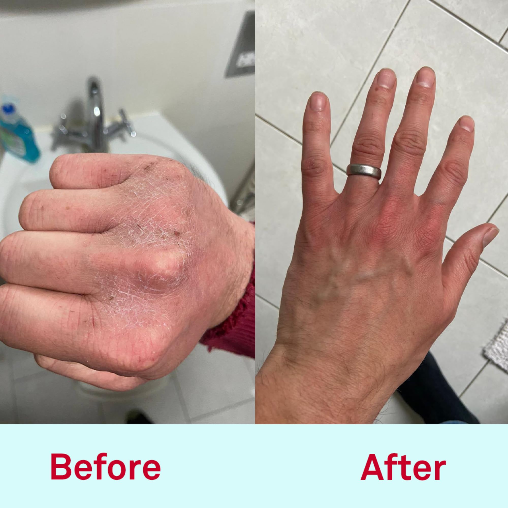 Nursem CARING HAND CREAM – 300ml | Fast absorbing and moisturising natural cream for hard working hands, repairing cream suitable for sensitive and dry skin (Unfragranced)