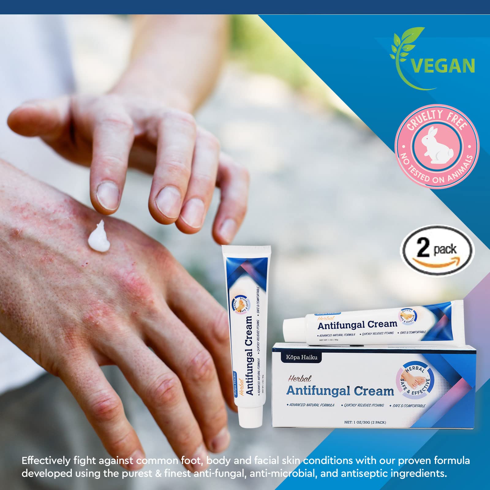 Antifungal Herbal Cream: for Athlete's Foot Jock Itch Ringworm – Moisturizing Botanical Formula for Healthy Skin (30 g (Pack of 2))