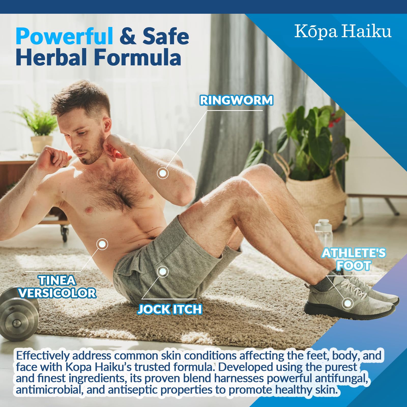 Antifungal Herbal Cream: for Athlete's Foot Jock Itch Ringworm – Moisturizing Botanical Formula for Healthy Skin (30 g (Pack of 2))